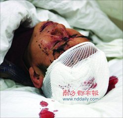 伤堕水乌