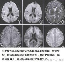 病起木犀已谢